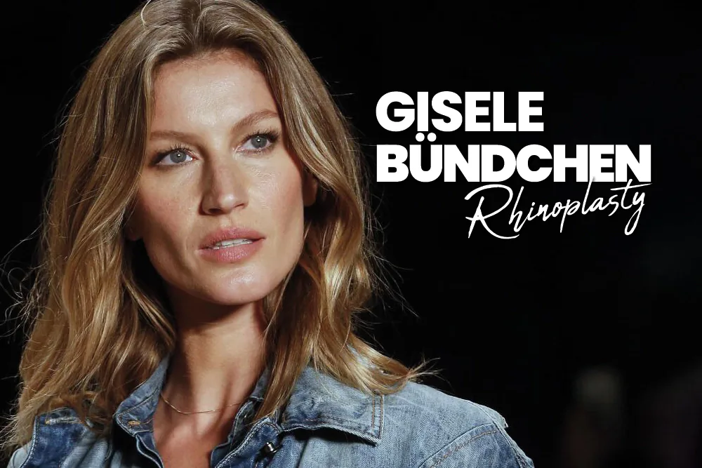 Gisele Bündchen Rhinoplasty