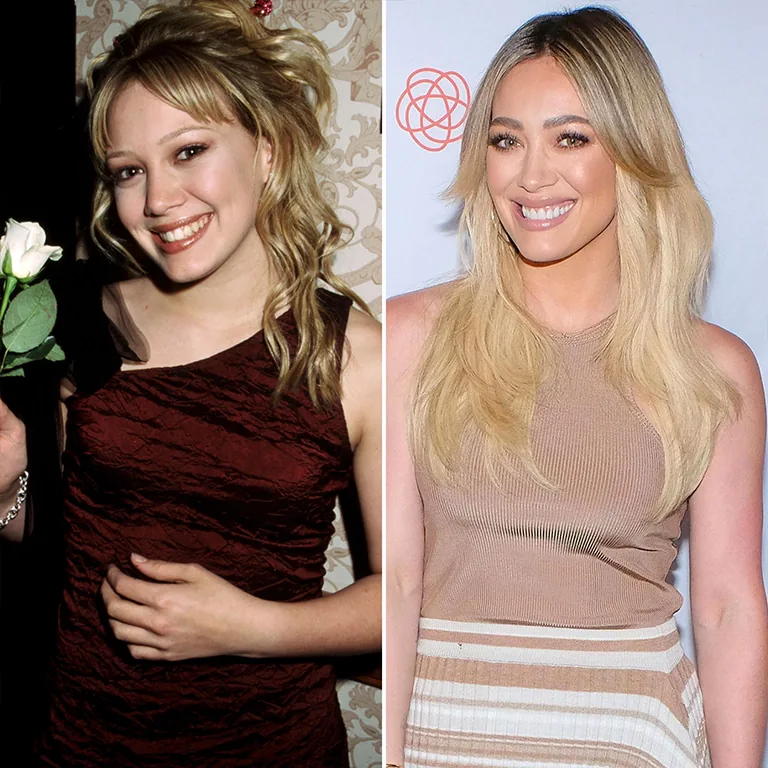 Hilary Duff Rhinoplasty Before and After