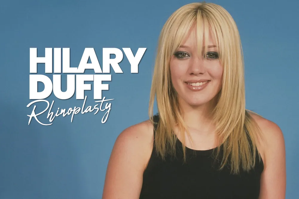 Hilary Duff Rhinoplasty