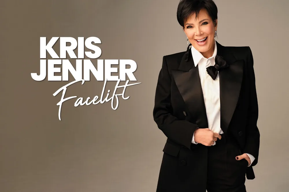Kris Jenner Facelift