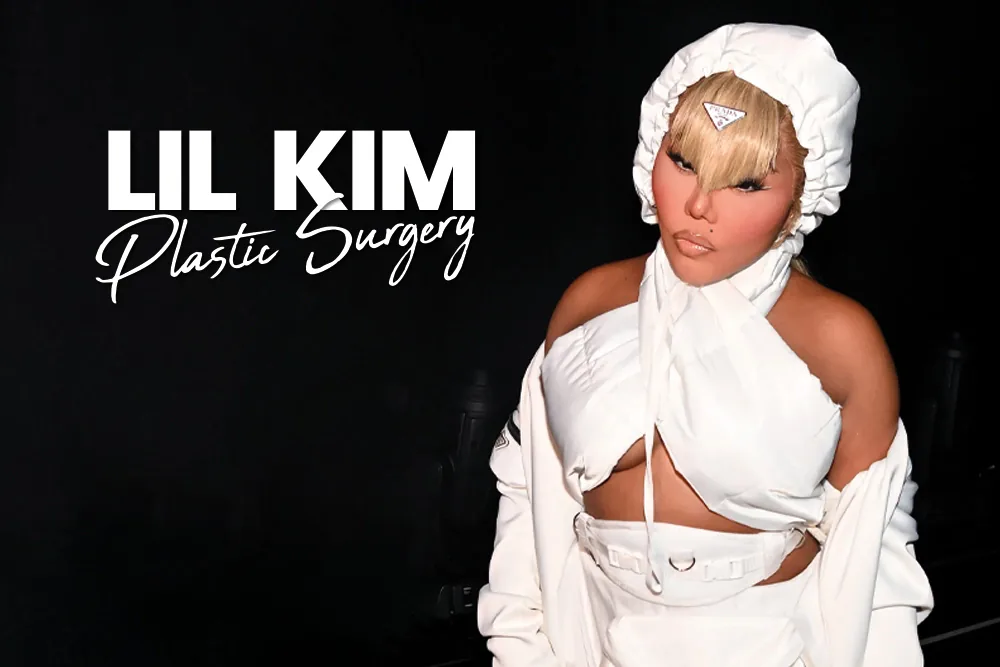 Lil Kim Plastic Surgery