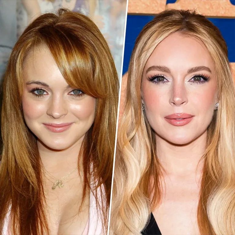 Lindsay Lohan Plastic Surgery Before and After