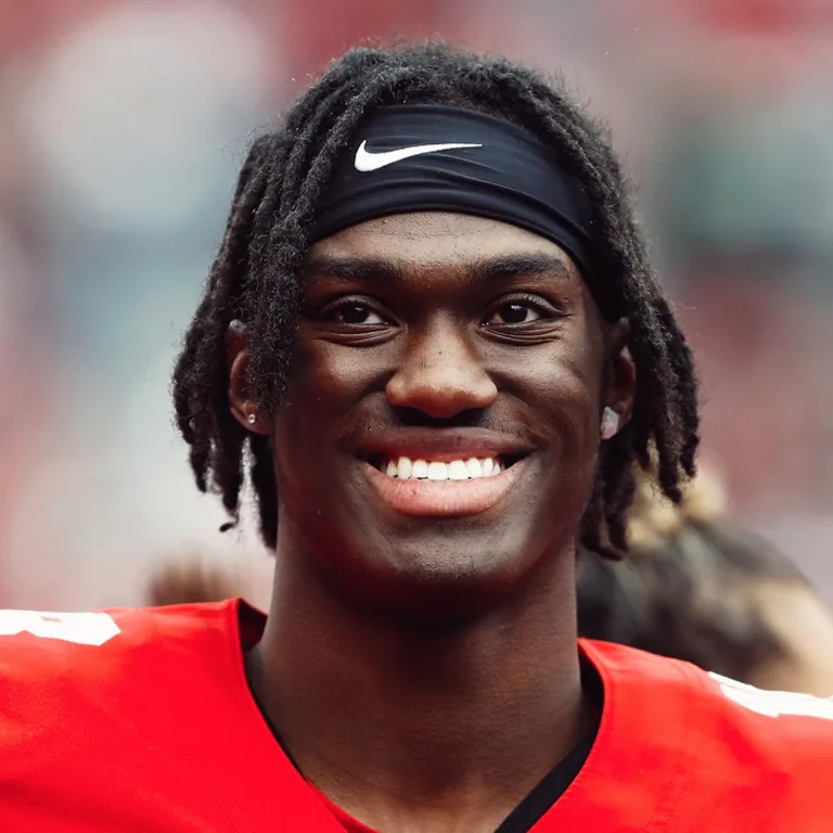 Marvin Harrison Smile Transformation