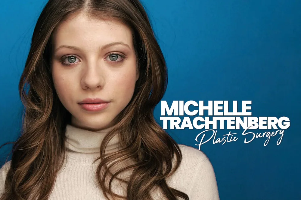 Michelle Trachtenberg Plastic Surgery