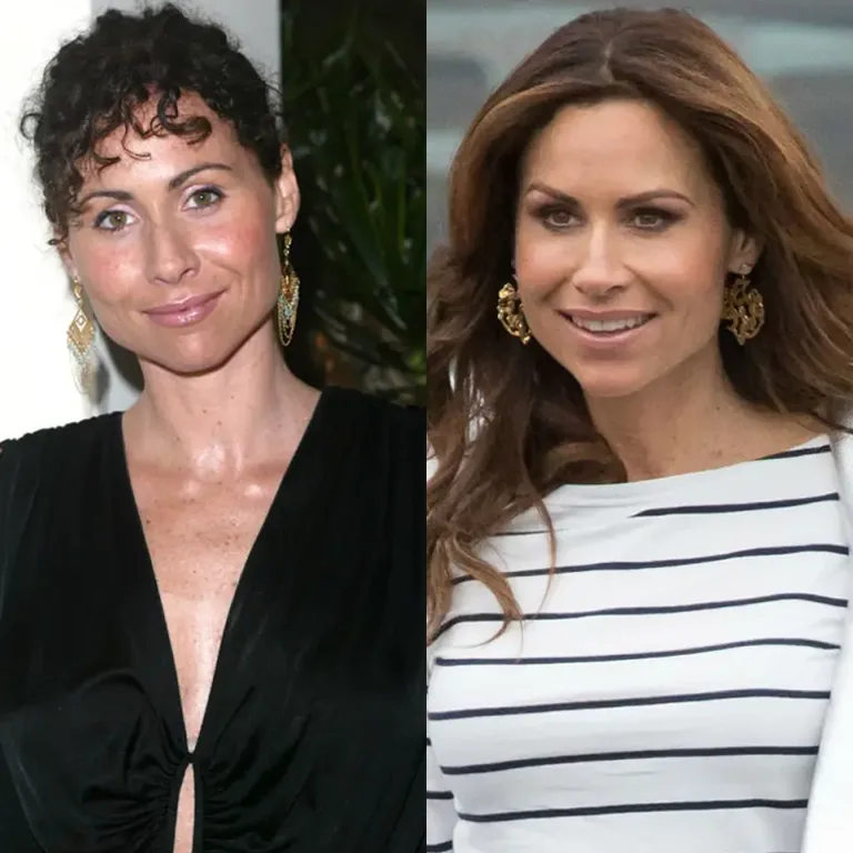 Minnie Driver Plastic Surgery Before and After