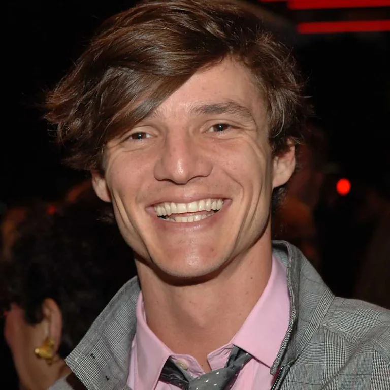 Pedro Pascal Teeth Before and After