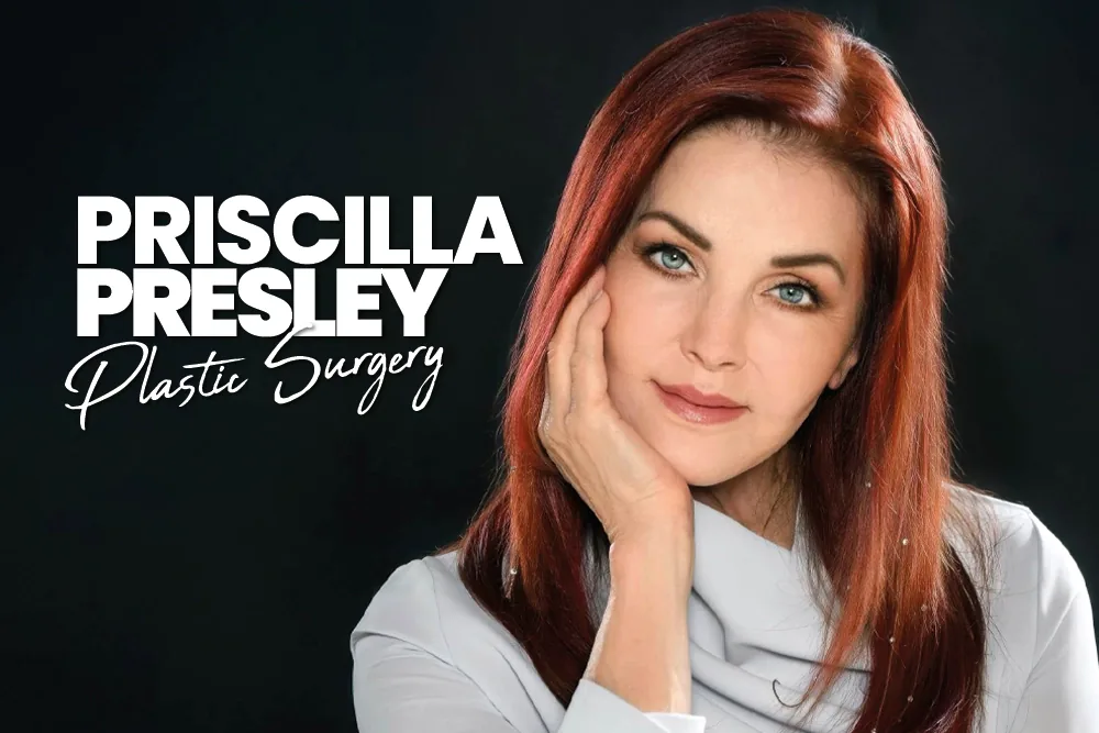 Priscilla Presley Plastic Surgery