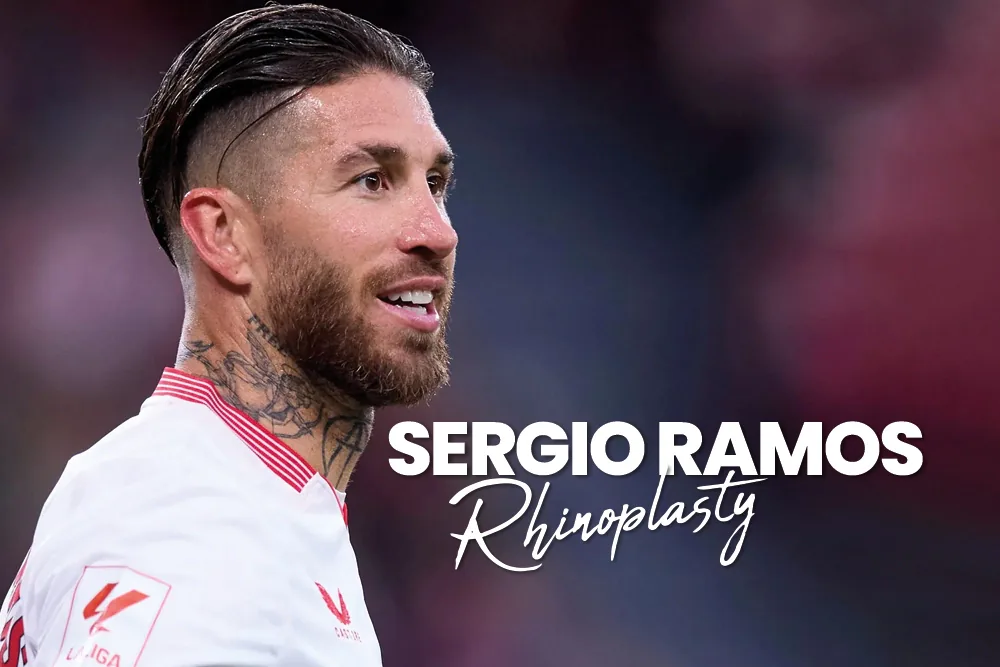 Sergio Ramos Rhinoplasty