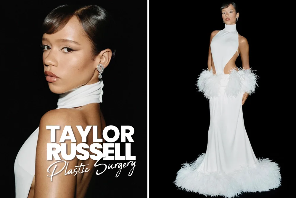 Taylor Russell Plastic Surgery