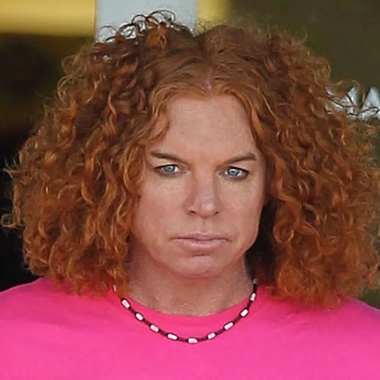The Dangers of Extreme Plastic Surgery