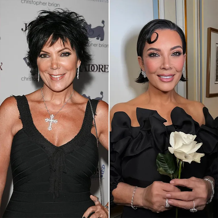 The Famous Pre Wedding Facelift What Did She Have Done