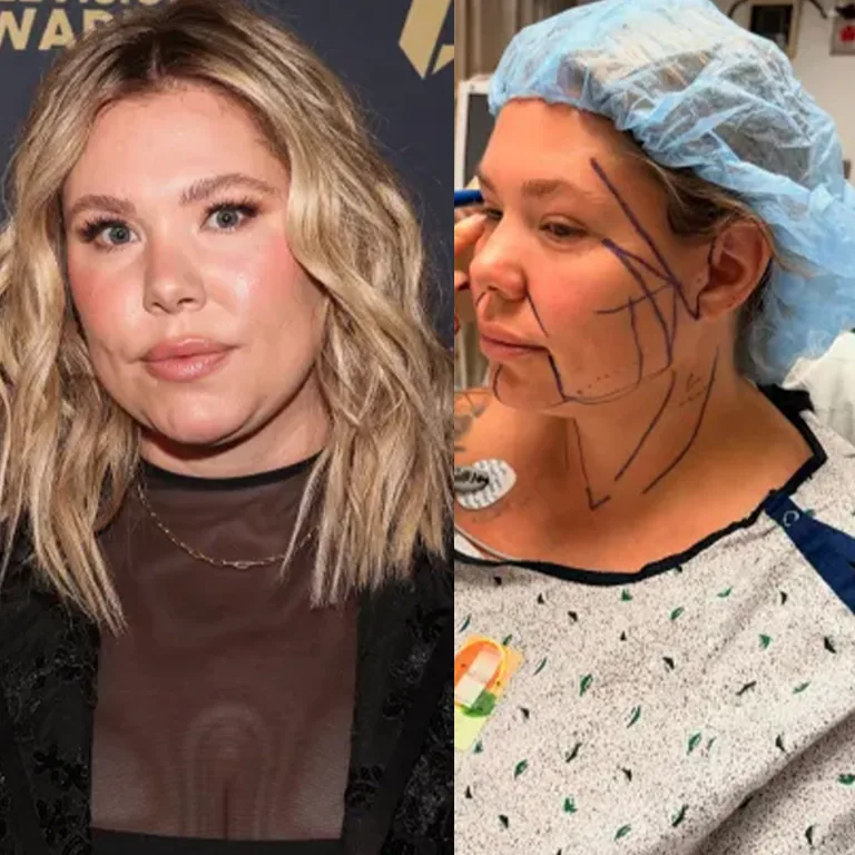 What is Recovery Like for Chin Liposuction