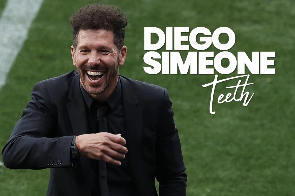 Diego Simeone Teeth