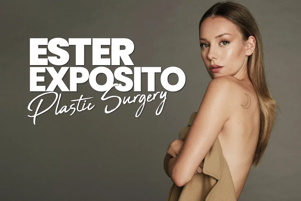 Ester Exposito Plastic Surgery