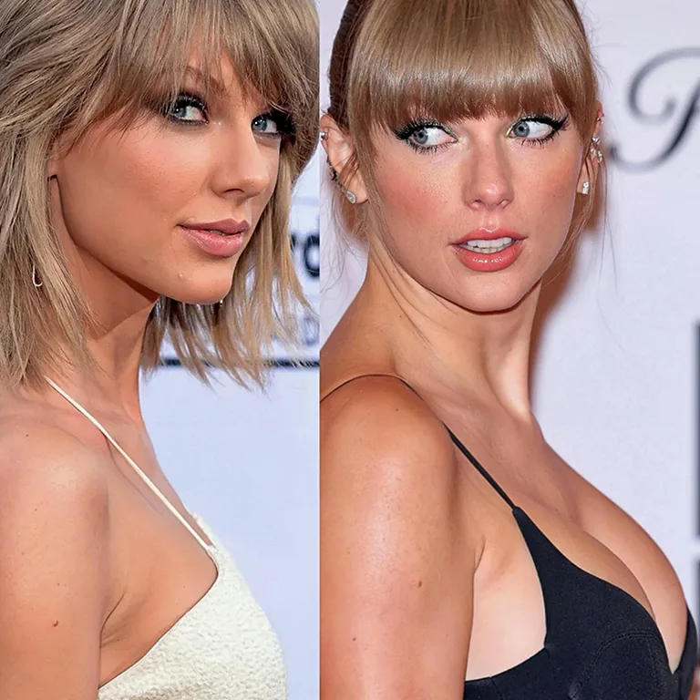 Taylor Swift Breast Surgery
