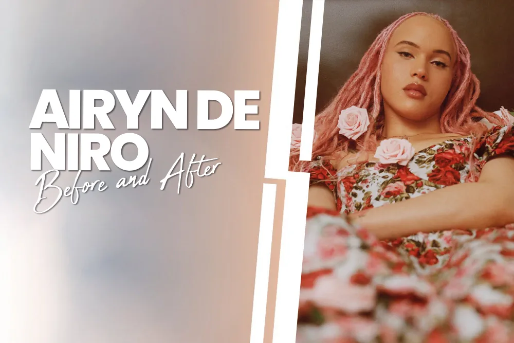 Airyn de Niro Before and After