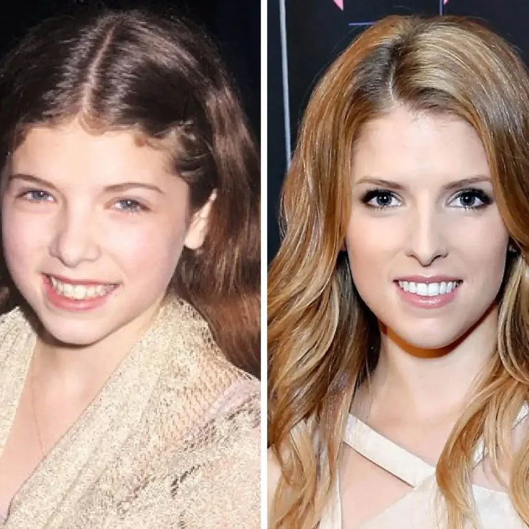 Anna Kendrick Nose Job