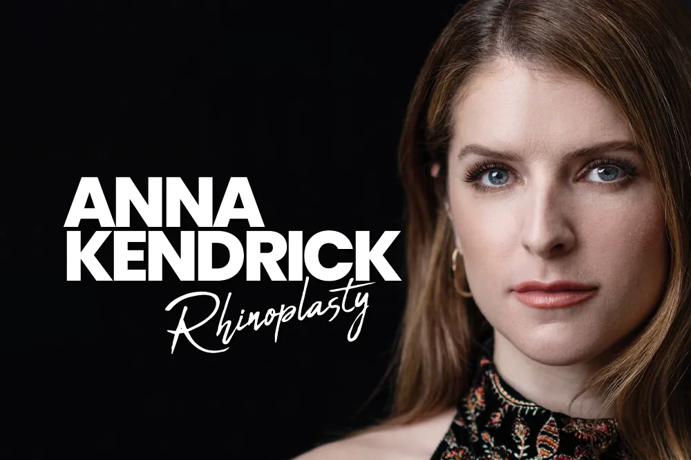 Anna Kendrick Rhinoplasty