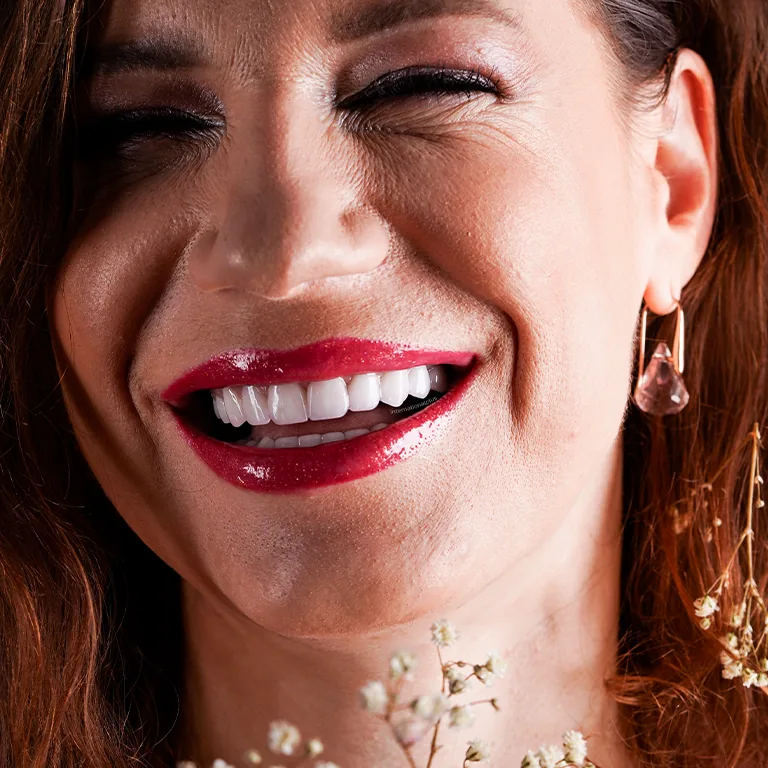 E-max Veneers Cost Turkey
