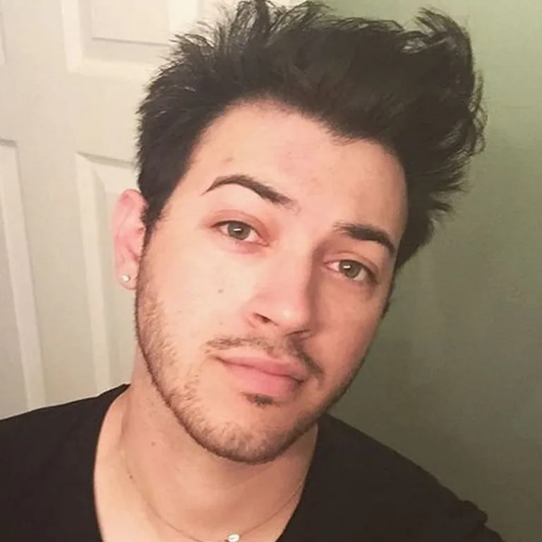 Manny MUA Plastic Surgery