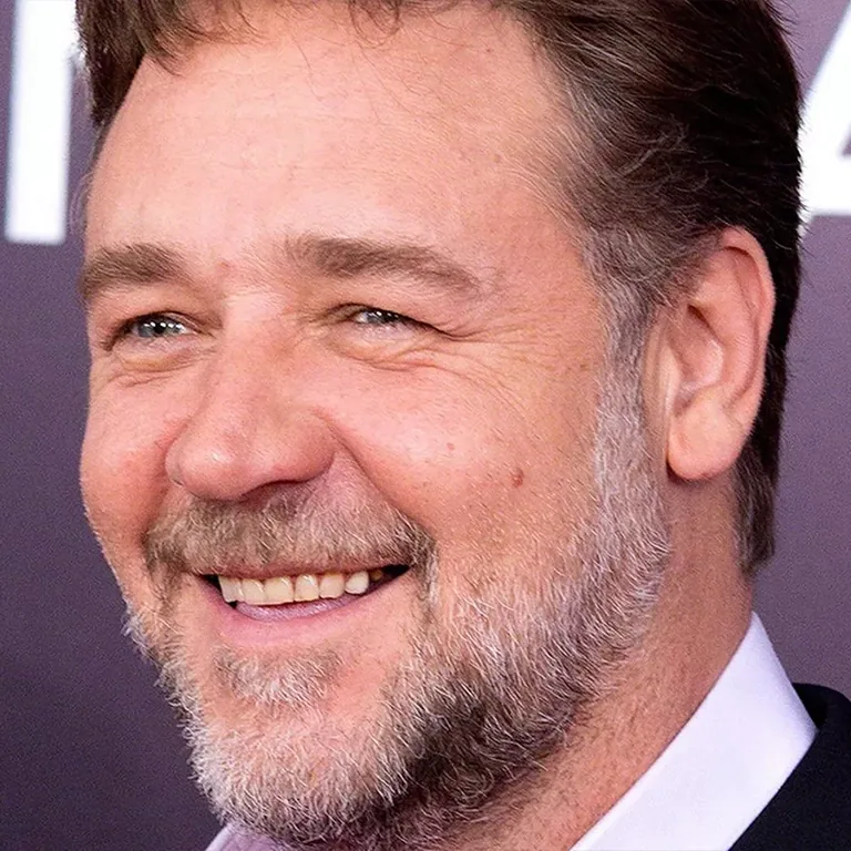 Russell Crowe Teeth Whitening