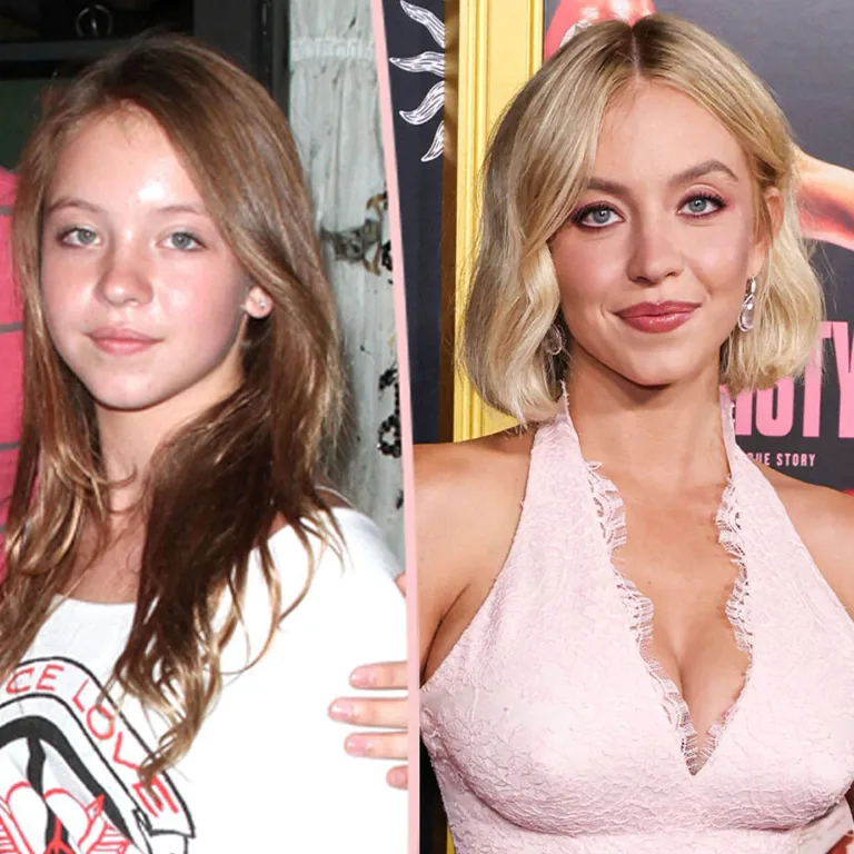 Sydney Sweeney Nose Job