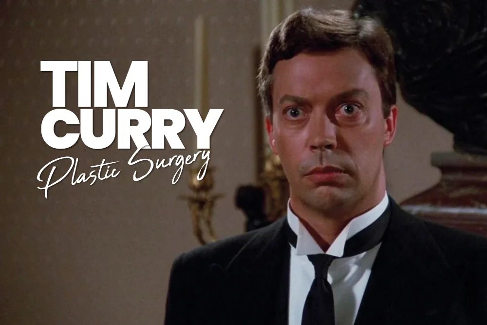 Tim Curry Plastic Surgery