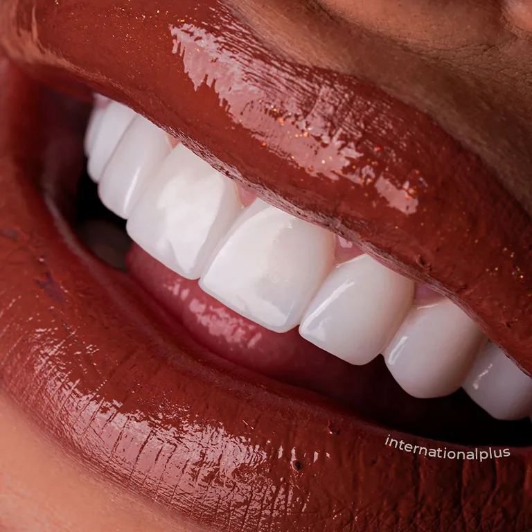 Aesthetics E-max vs Zirconium