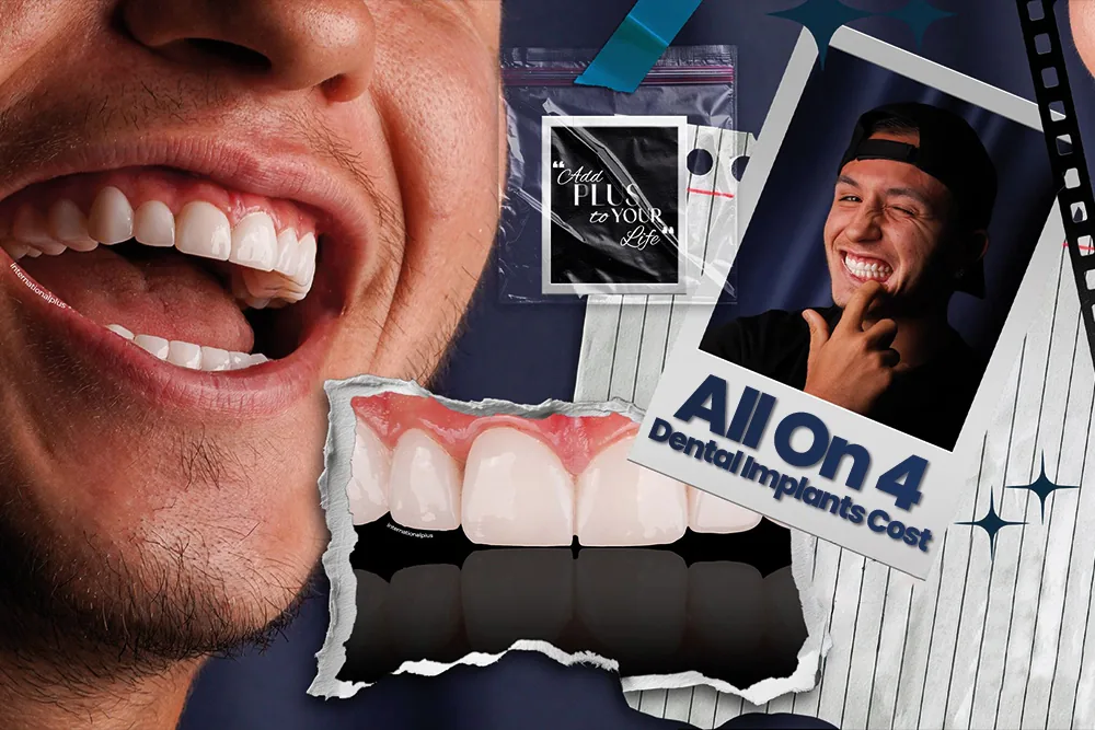 All On 4 Dental Implants Cost