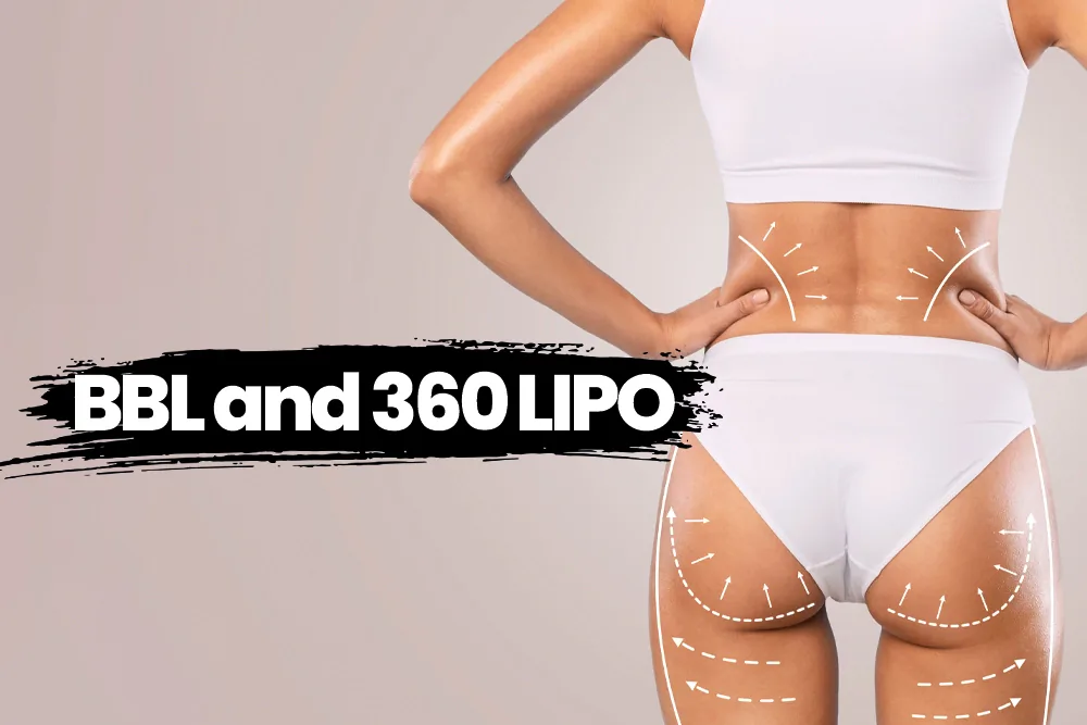 BBL and 360 Lipo