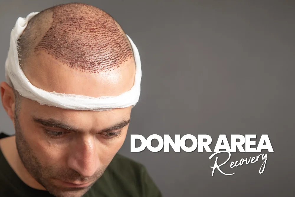 Donor Area Recovery