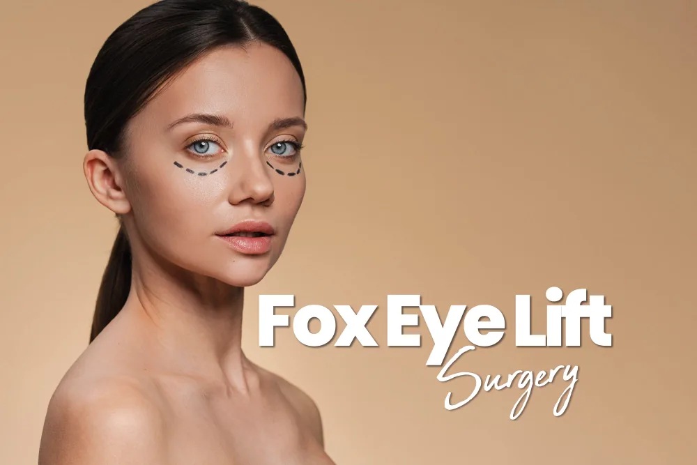 Fox Eye Lift Surgery