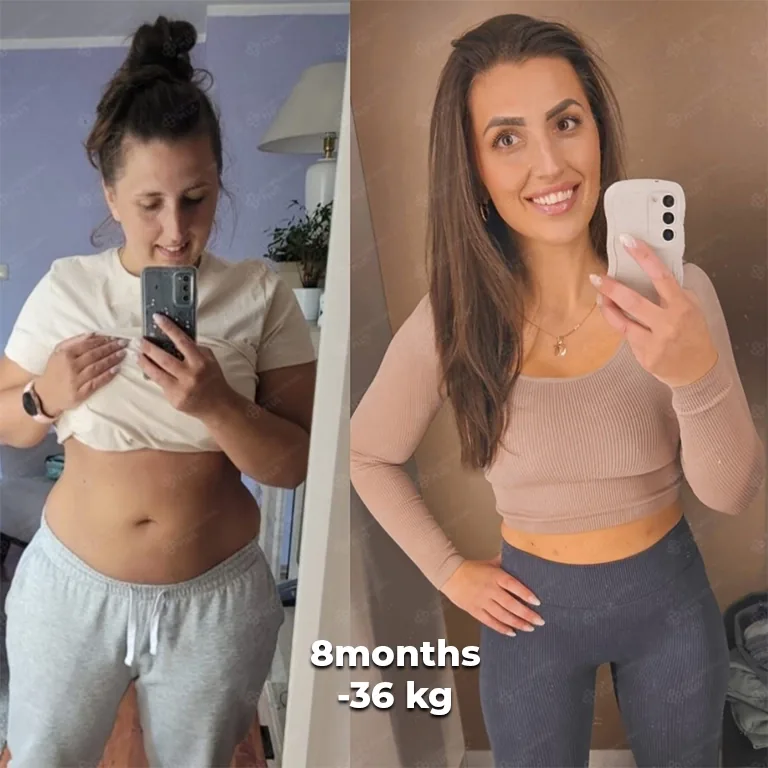 Gastric Botox Results