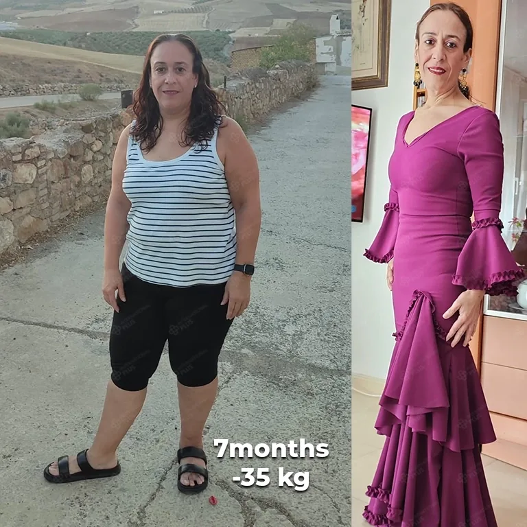 Metabolic Surgery Explained