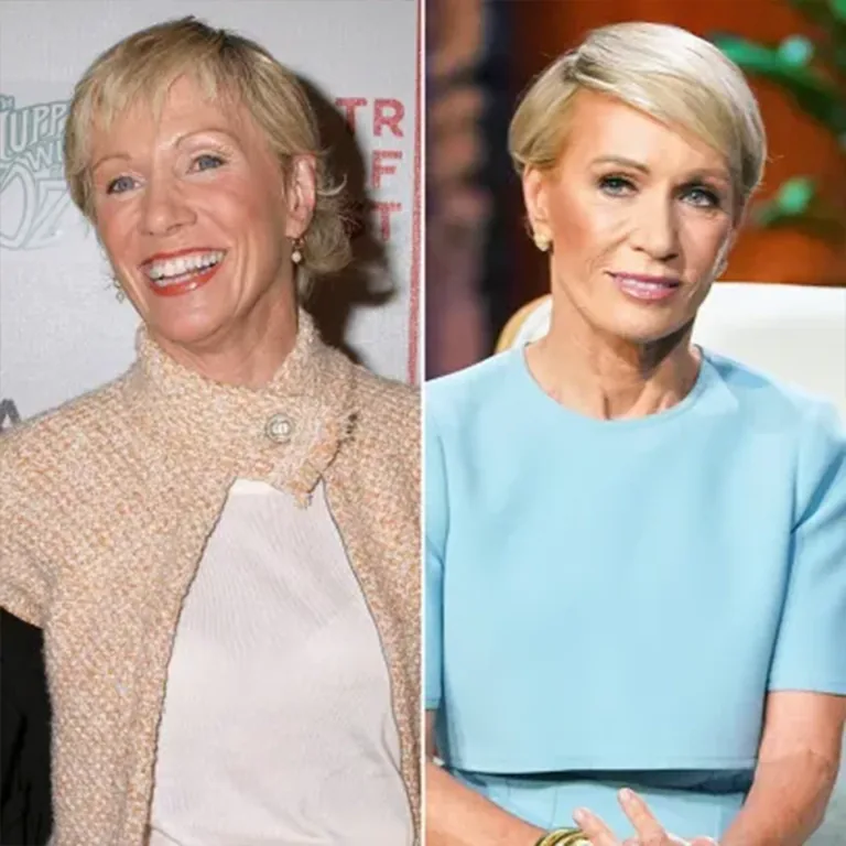 Neck Lift Procedures Explained