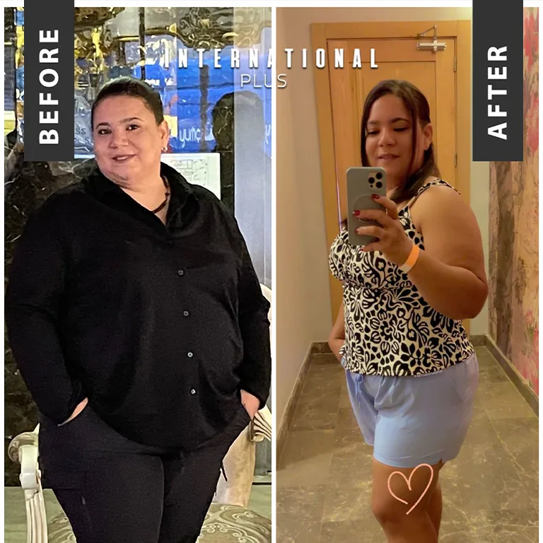 Pros and Cons Gastric Sleeve