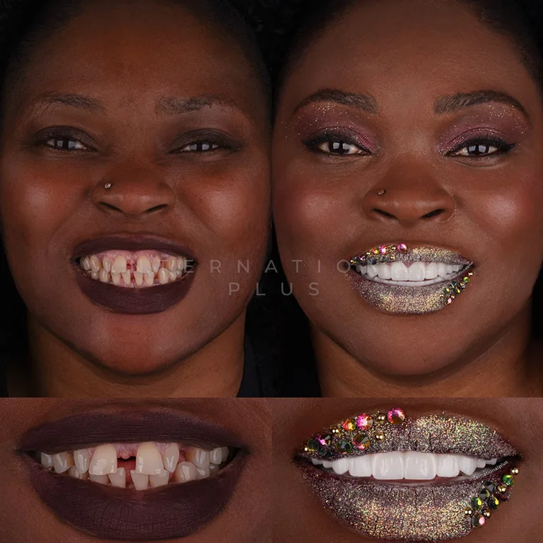 Same Day Dentistry Turkey