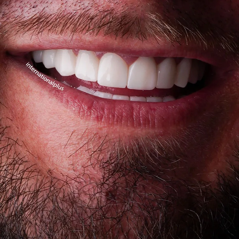Turkey Teeth Packages Cost 2026