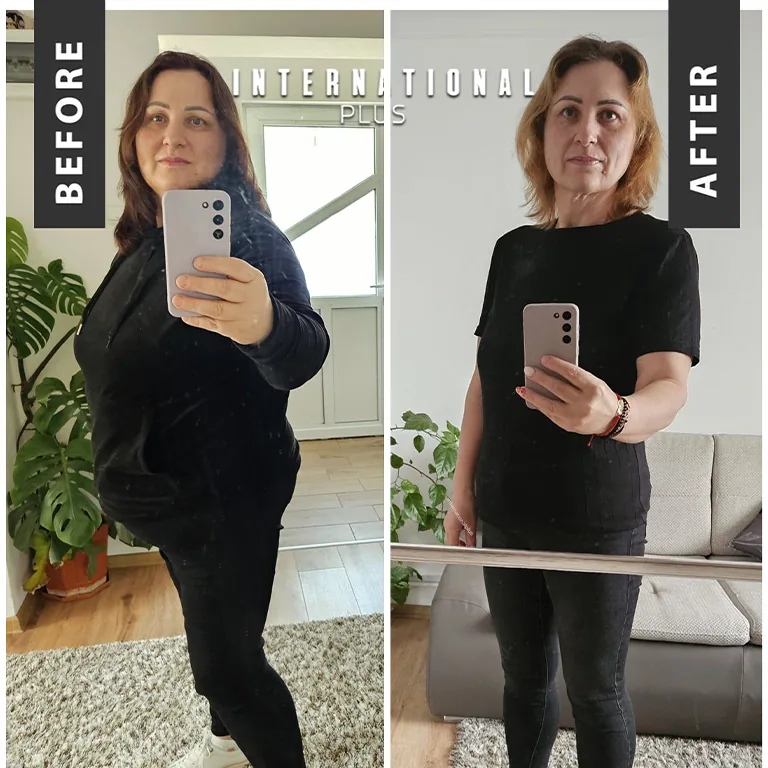 Weight Loss With Balloon