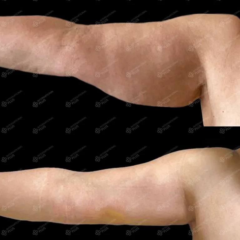 When To Get Skin Surgery