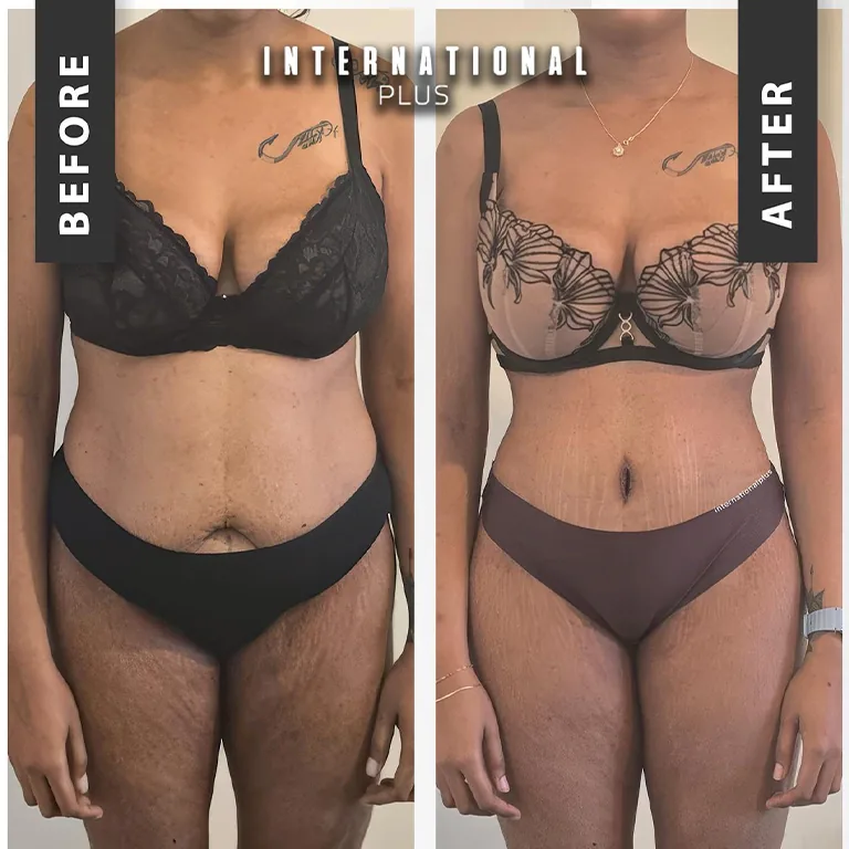 Why Is Plastic Surgery Cheaper In Turkey