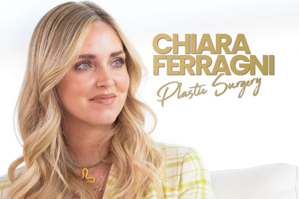 Chiara Ferragni Plastic Surgery