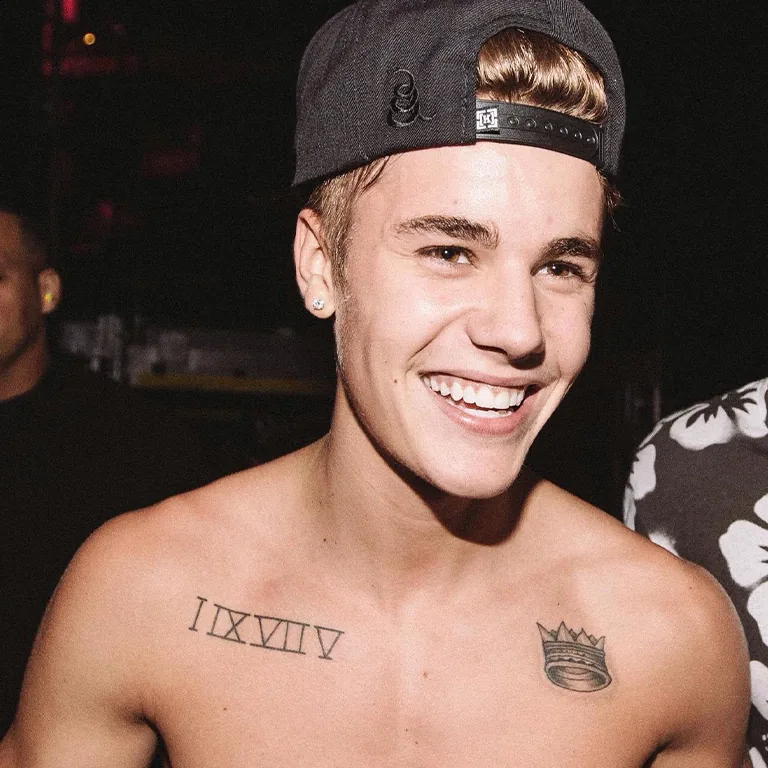 Justin Bieber Teeth Before and After