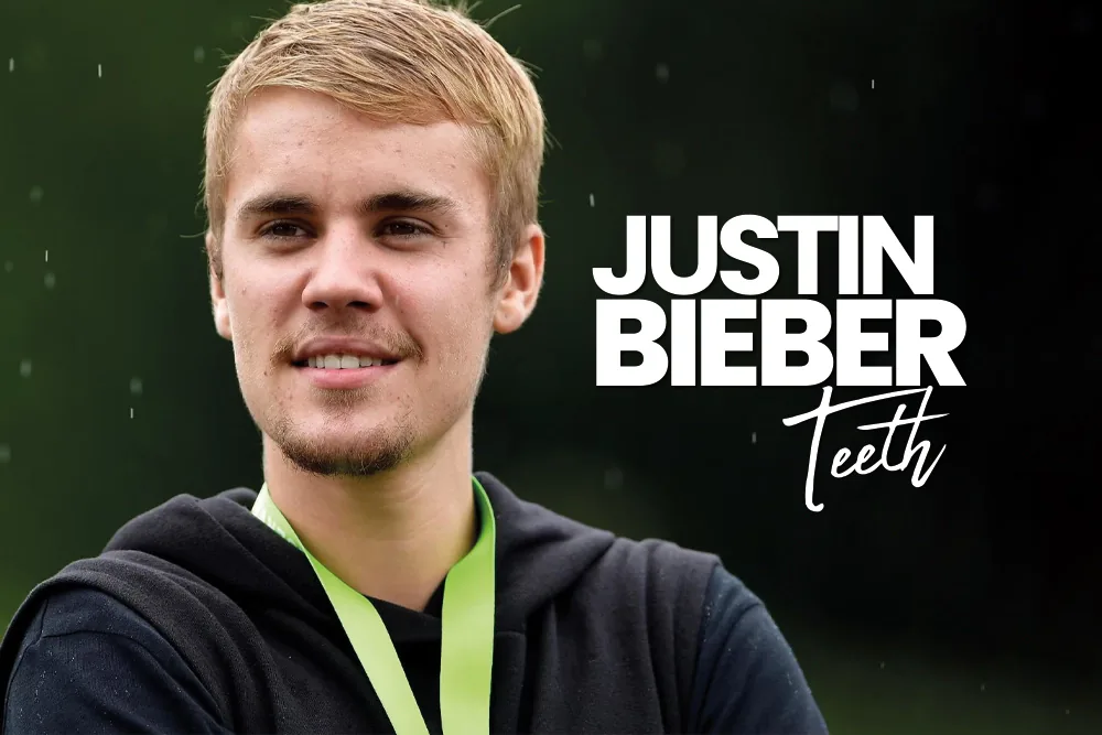 Justin Bieber Teeth