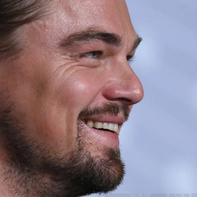 1. Leonardo DiCaprio Plastic Surgery