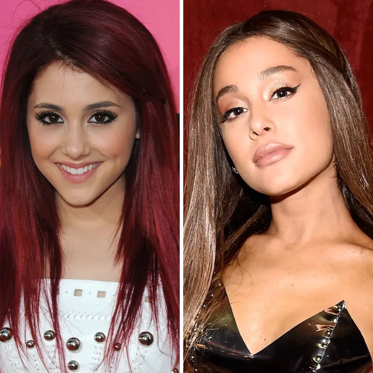 Ariana Grande Plastic Surgery