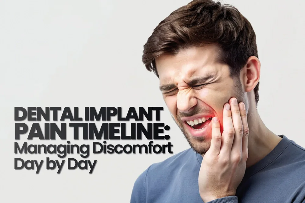 Dental Implant Pain Timeline: Managing Discomfort Day by Day for a Perfect Smile