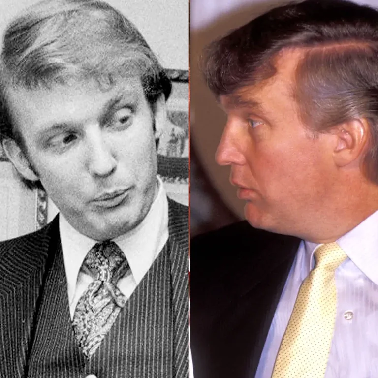 Donald Trump Scalp Reduction Mystery