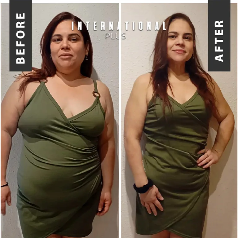 Medical Weight Loss Support Istanbul