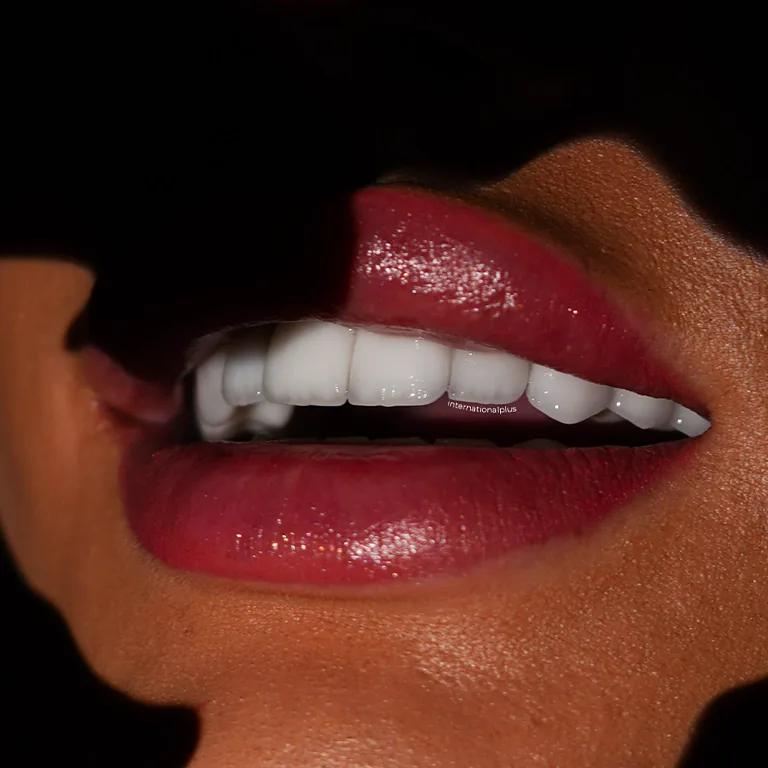 Minimal Prep Veneers vs Reversible Bonding